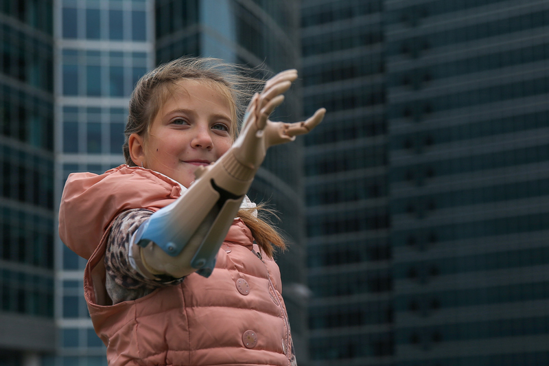 Шесть маленьких киборгов: в России детей учат пользоваться протезами, фото